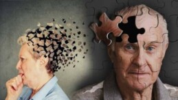 Keskin: Alzheimer’ı yavaşlatmak elimizde