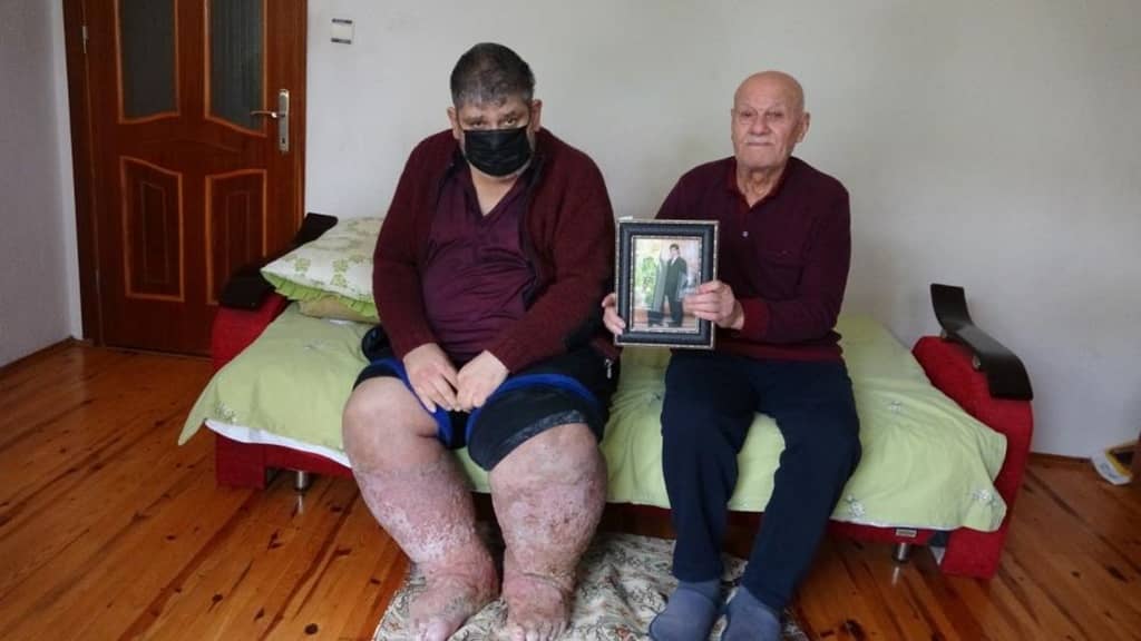 9 yıldır insan içine çıkamıyor