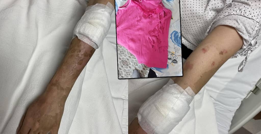 Bomba gibi patladı genç kız ölümden döndü