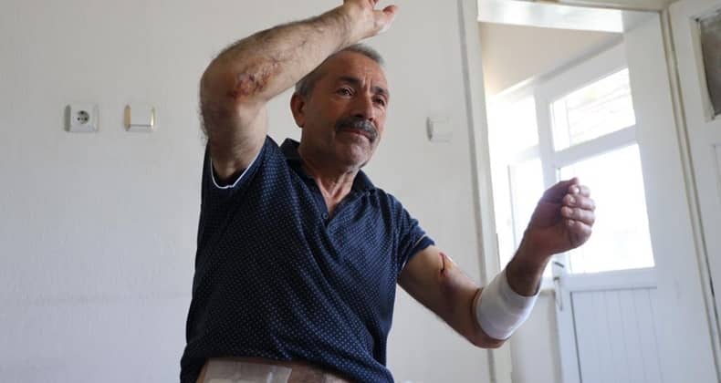 Köpeklerin Saldırdığı Adam Dehşeti Yaşadı