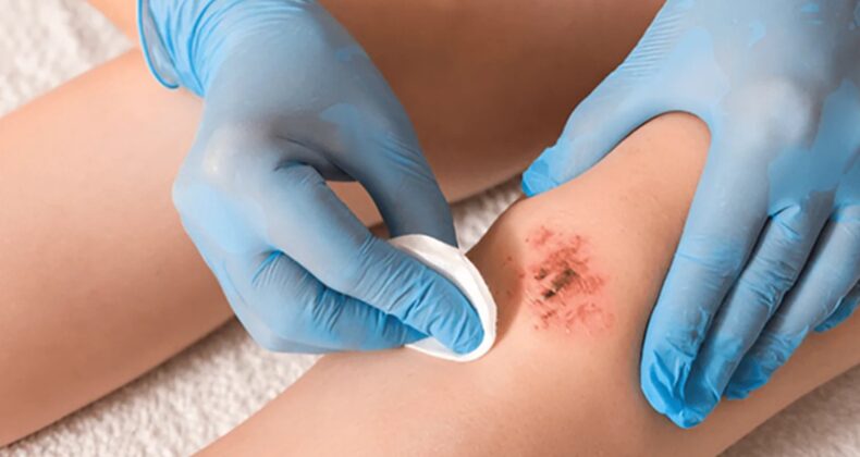 Batikon’u Bilmeden Kullanmayın!