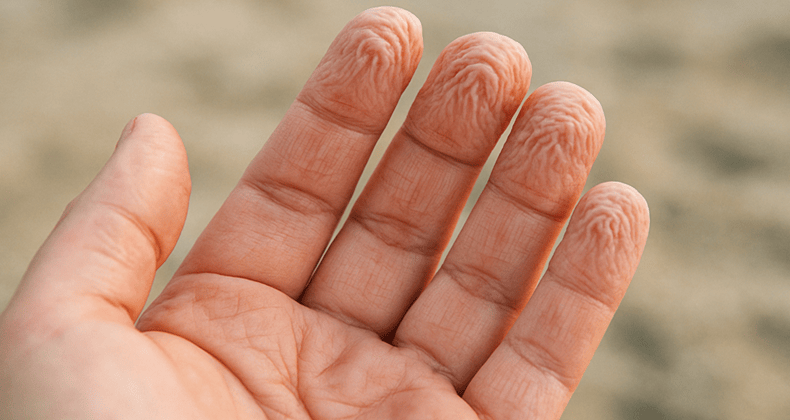 Parmaklarınız uzun süre suda kaldığında neden kırışır